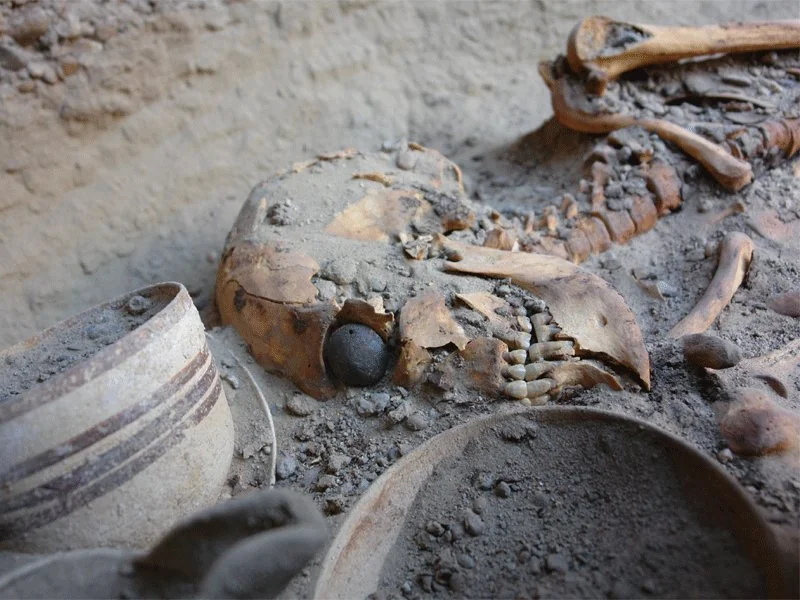 Time Travel: Exploring the  5,000-year-old prosthetic eye in Zabol