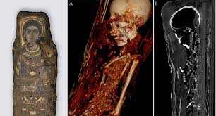 Unlocking the Fascinating Secrets Enclosed Within Scanned Mummies