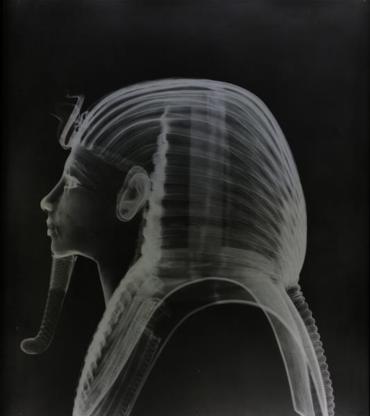 X-ray Insights: The Technological Marvel of Tutankhamun’s Golden Mask