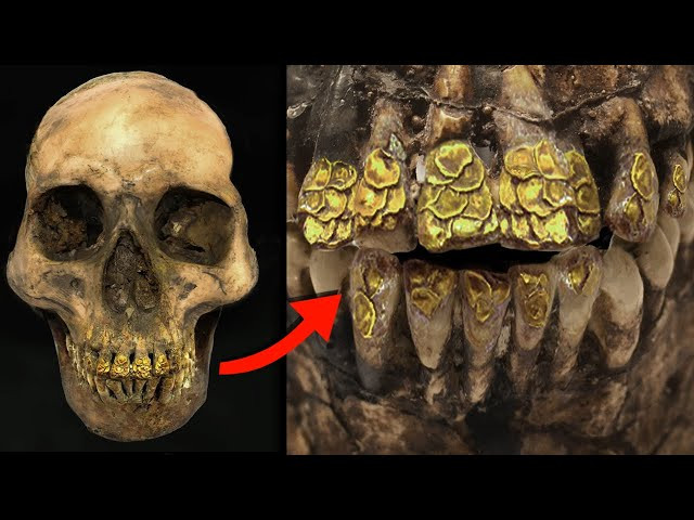 The Bolinao Skull decoding the golden smile of ancient Philippines