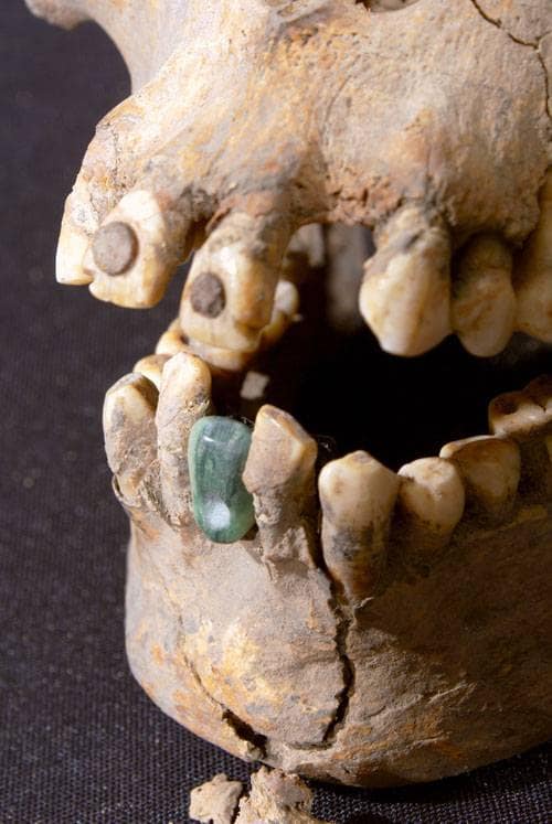 The Discovery of a 1,600-Year-Old Woman’s Skeleton with Jewelry in Her Teeth: What Can We Learn?