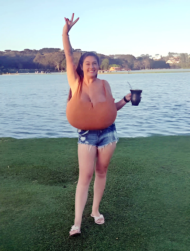 Brazilian Woman with Gigantomastia Finds Freedom After Life-Changing Surgery